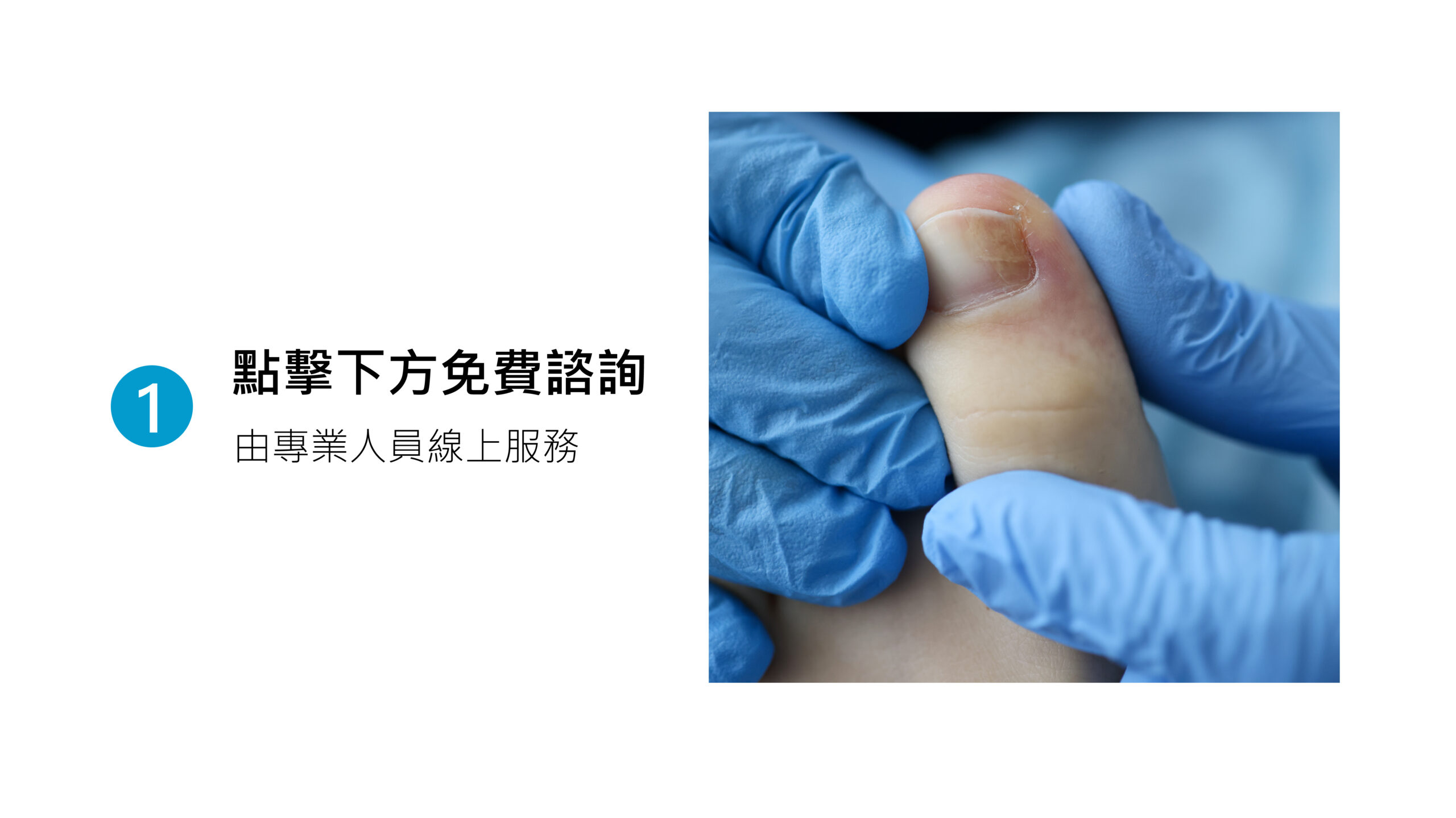 美甲 健甲 凍甲 灰指甲 耐恩適 nail nails 拇指外翻 甲溝炎 嵌甲